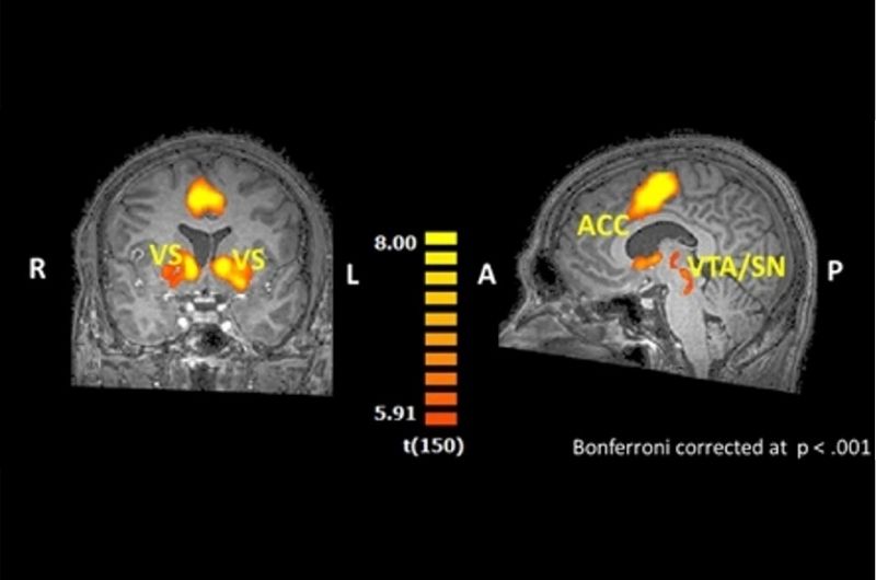 Les neurosciences pour trouver ses motivations profondes - Comment trouver des motivations qui ne s'épuisent pas? - Be Alternatives conférences formations